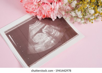 a snapshot of an ultrasound scan and flowers on a pink background pregnancy and motherhood concept, conscious parenthood, the joy of having a child in the family
