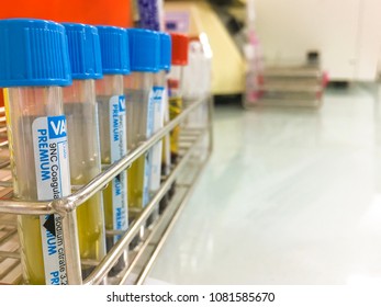 Sodium Citrate Blood Tubes On Metal Rack. Plasma Separated From Whole Blood For Coagulogram Tests.