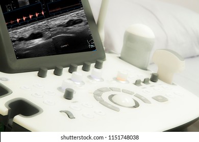 Soft And Blurry ULTRASOUND COLOR DOPPLER : Acute DVT Of Right Iliac Vein,right Superficical Femoral Vein And Right Popliteal Vein.