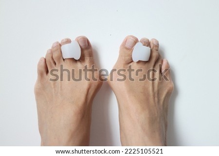 Soft defocused photo of a pair of bunion feet wearing toe separators closed up on off white background. Photo is soft focused with some blur parts