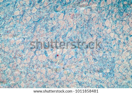 soft palate tissue under the microscope 100x