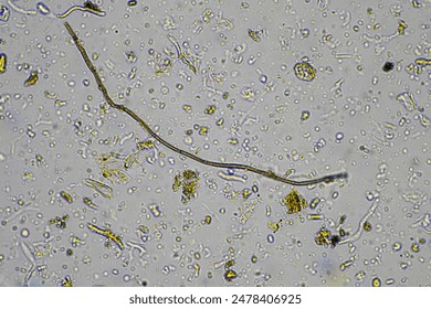 soil microbe organisms in a soil sample from forest on a regenerative cropping and livestock farm  - Powered by Shutterstock