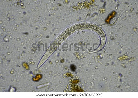 soil microbe organisms in a soil sample from forest on a regenerative cropping and livestock farm 