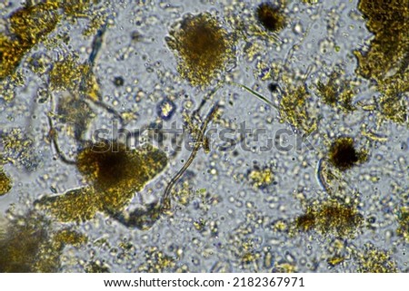 soil microbes organisms in a soil and compost sample, fungus and fungi and under the microscope in regenerative agriculture. in australia.
