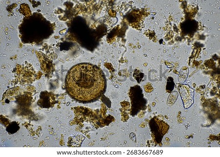 soil microbes organisms in a soil and compost sample, fungus and fungi and under the microscope in regenerative agriculture. in australia.	
