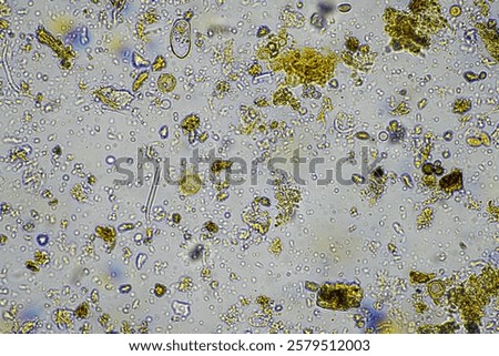 soil microbes under the microscope. microorganisms with fungus in compost