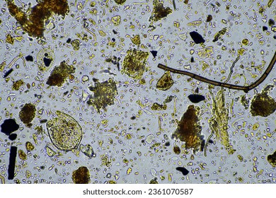 soil microorganisms close up under the microscope. in a soil samlple from a farm