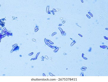 soil microorganisms under a microscope including amoeba, flagellates, nematodes, fungi, bacteria	
