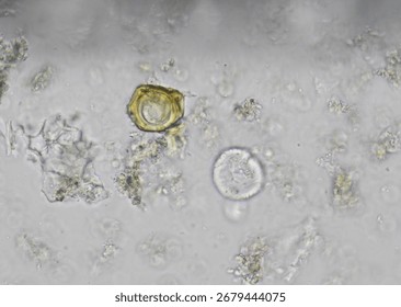 soil microorganisms under a microscope including amoeba, flagellates, nematodes, fungi, bacteria	