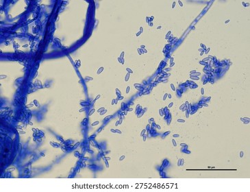 soil microorganisms under a microscope including amoeba, flagellates, nematodes, fungi, bacteria	