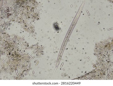 soil microorganisms under a microscope including amoeba, flagellates, nematodes, fungi, bacteria	