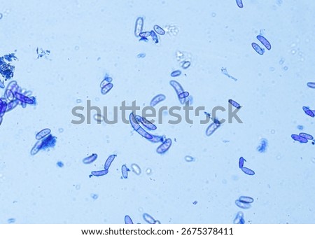 soil microorganisms under a microscope including amoeba, flagellates, nematodes, fungi, bacteria	