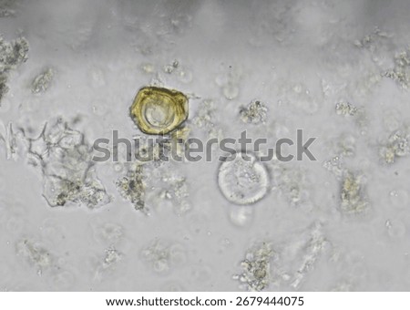 soil microorganisms under a microscope including amoeba, flagellates, nematodes, fungi, bacteria	