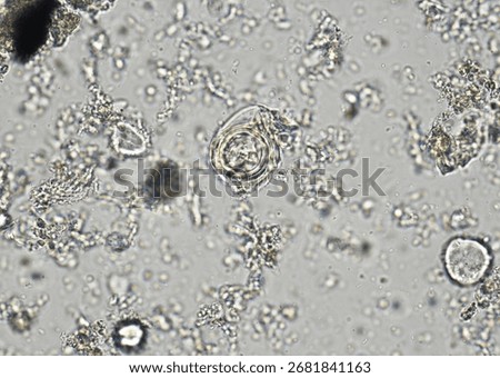 soil microorganisms under a microscope including amoeba, flagellates, nematodes, fungi, bacteria	