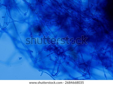 soil microorganisms under a microscope including amoeba, flagellates, nematodes, fungi, bacteria	