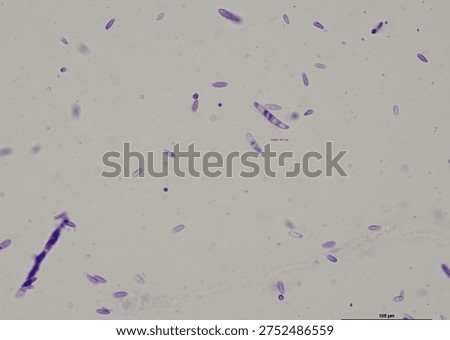 soil microorganisms under a microscope including amoeba, flagellates, nematodes, fungi, bacteria	
