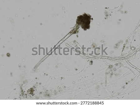 soil microorganisms under a microscope including amoeba, flagellates, nematodes, fungi, bacteria	