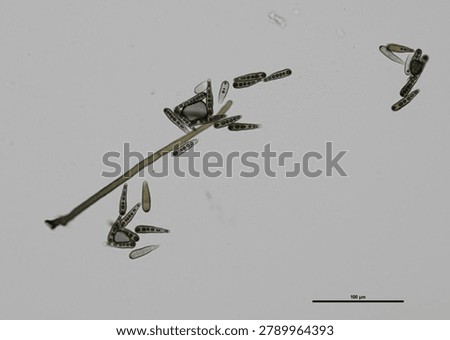 soil microorganisms under a microscope including amoeba, flagellates, nematodes, fungi, bacteria	