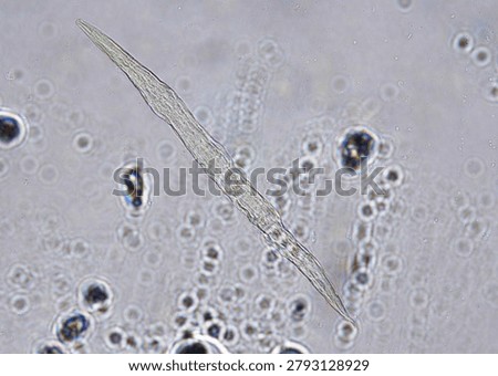 soil microorganisms under a microscope including amoeba, flagellates, nematodes, fungi, bacteria	