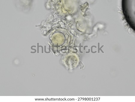 soil microorganisms under a microscope including amoeba, flagellates, nematodes, fungi, bacteria	
