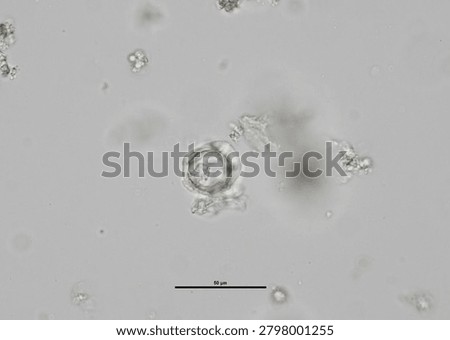 soil microorganisms under a microscope including amoeba, flagellates, nematodes, fungi, bacteria	
