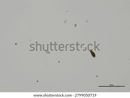 soil microorganisms under a microscope including amoeba, flagellates, nematodes, fungi, bacteria	
