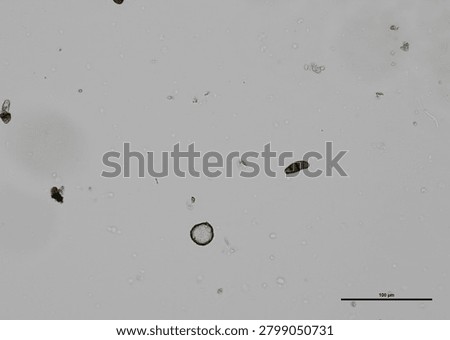 soil microorganisms under a microscope including amoeba, flagellates, nematodes, fungi, bacteria	