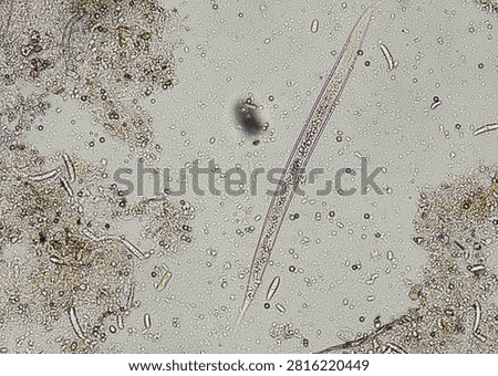 soil microorganisms under a microscope including amoeba, flagellates, nematodes, fungi, bacteria	
