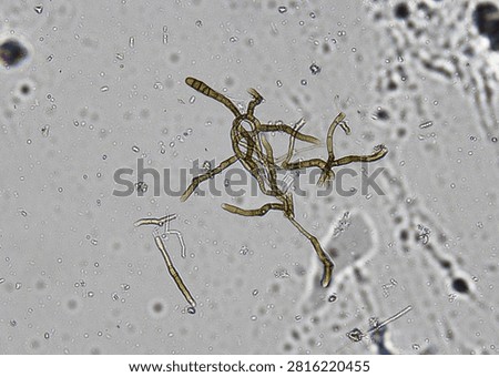 soil microorganisms under a microscope including amoeba, flagellates, nematodes, fungi, bacteria	
