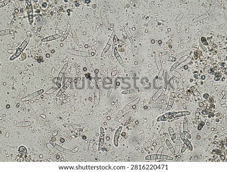 soil microorganisms under a microscope including amoeba, flagellates, nematodes, fungi, bacteria	