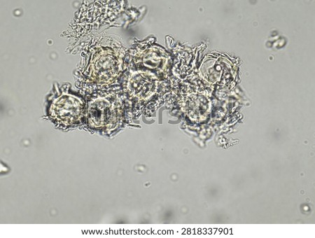 soil microorganisms under a microscope including amoeba, flagellates, nematodes, fungi, bacteria	