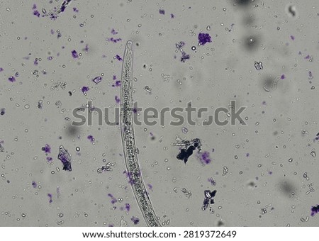 soil microorganisms under a microscope including amoeba, flagellates, nematodes, fungi, bacteria	