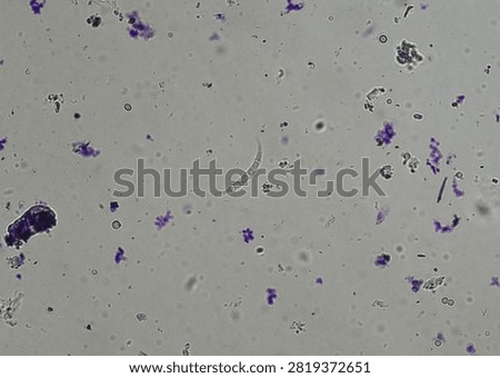 soil microorganisms under a microscope including amoeba, flagellates, nematodes, fungi, bacteria	