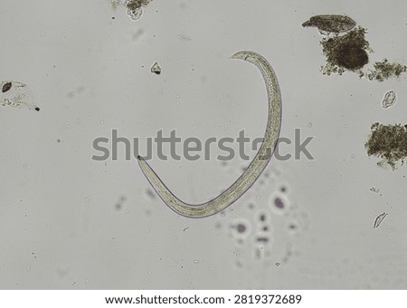 soil microorganisms under a microscope including amoeba, flagellates, nematodes, fungi, bacteria	