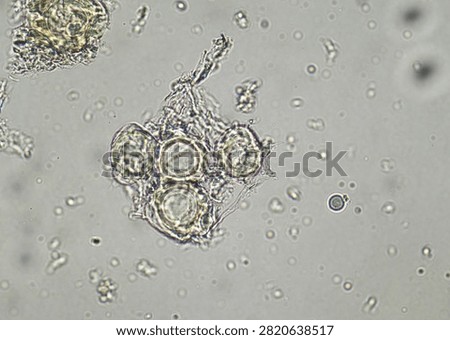 soil microorganisms under a microscope including amoeba, flagellates, nematodes, fungi, bacteria	