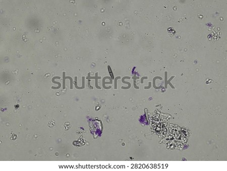 soil microorganisms under a microscope including amoeba, flagellates, nematodes, fungi, bacteria	