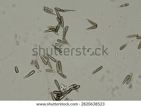 soil microorganisms under a microscope including amoeba, flagellates, nematodes, fungi, bacteria	