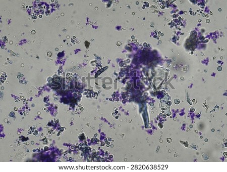 soil microorganisms under a microscope including amoeba, flagellates, nematodes, fungi, bacteria	