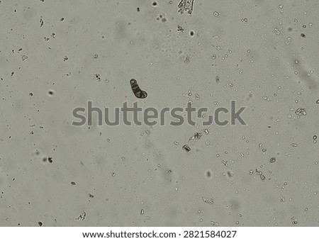 soil microorganisms under a microscope including amoeba, flagellates, nematodes, fungi, bacteria	