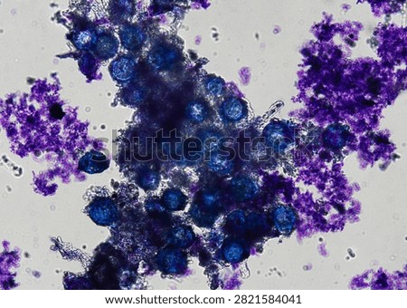 soil microorganisms under a microscope including amoeba, flagellates, nematodes, fungi, bacteria	