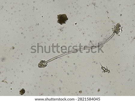 soil microorganisms under a microscope including amoeba, flagellates, nematodes, fungi, bacteria	