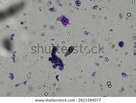 soil microorganisms under a microscope including amoeba, flagellates, nematodes, fungi, bacteria	