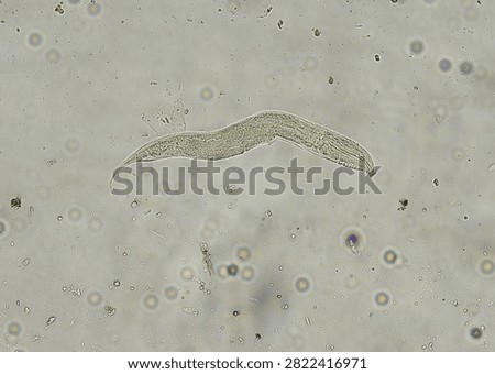 soil microorganisms under a microscope including amoeba, flagellates, nematodes, fungi, bacteria	