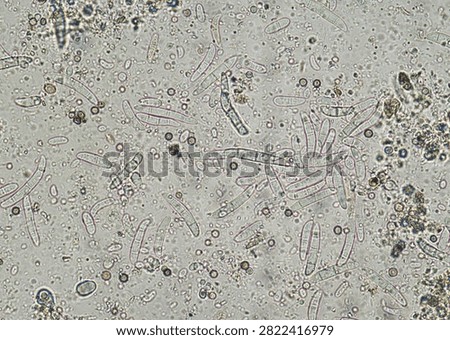 soil microorganisms under a microscope including amoeba, flagellates, nematodes, fungi, bacteria	