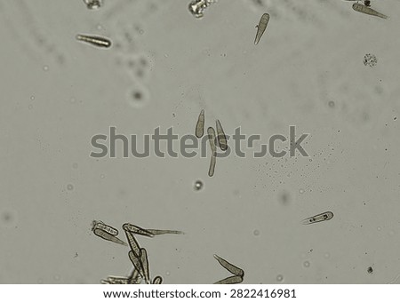 soil microorganisms under a microscope including amoeba, flagellates, nematodes, fungi, bacteria	
