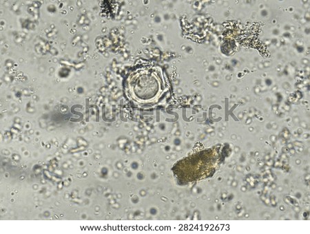 soil microorganisms under a microscope including amoeba, flagellates, nematodes, fungi, bacteria	
