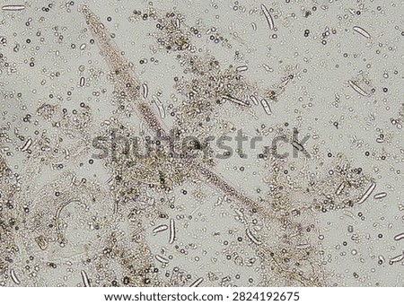 soil microorganisms under a microscope including amoeba, flagellates, nematodes, fungi, bacteria	