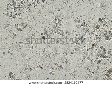 soil microorganisms under a microscope including amoeba, flagellates, nematodes, fungi, bacteria	