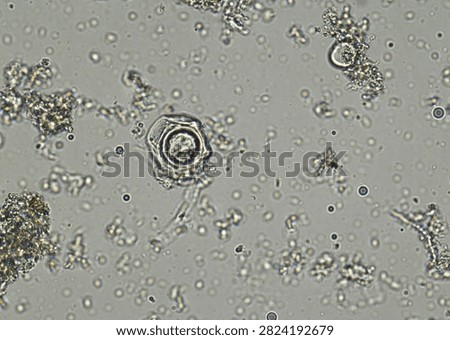 soil microorganisms under a microscope including amoeba, flagellates, nematodes, fungi, bacteria	