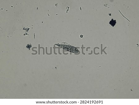 soil microorganisms under a microscope including amoeba, flagellates, nematodes, fungi, bacteria	